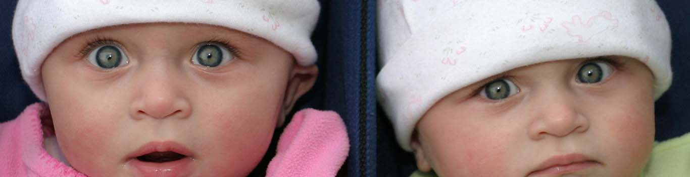 Do Identical Twins Have the Same DNA? Research Says Not Quite
