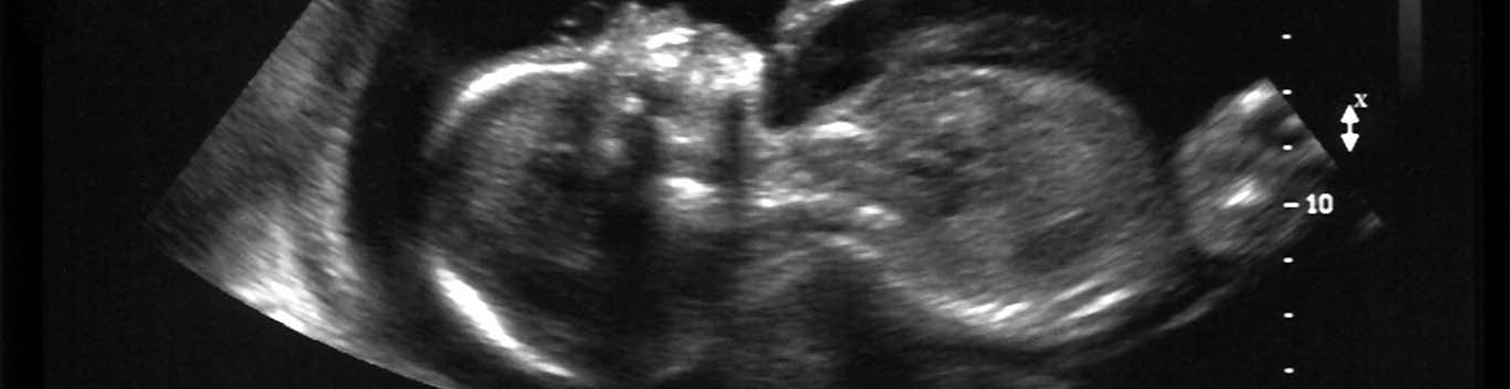 Week Ultrasound - Pregnancy Scan - Huggies AU