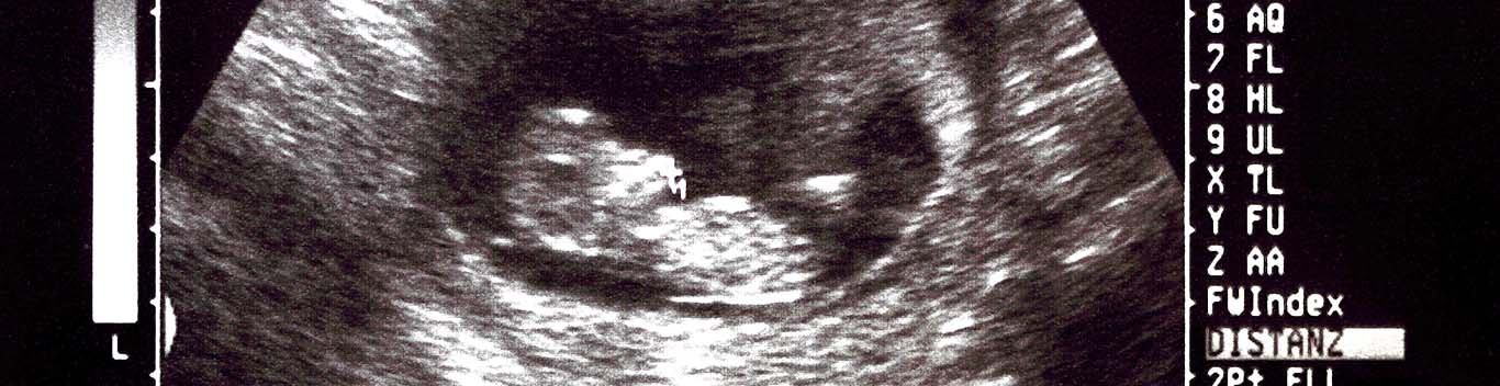 9 what to week ultrasound expect at 9 Weeks
